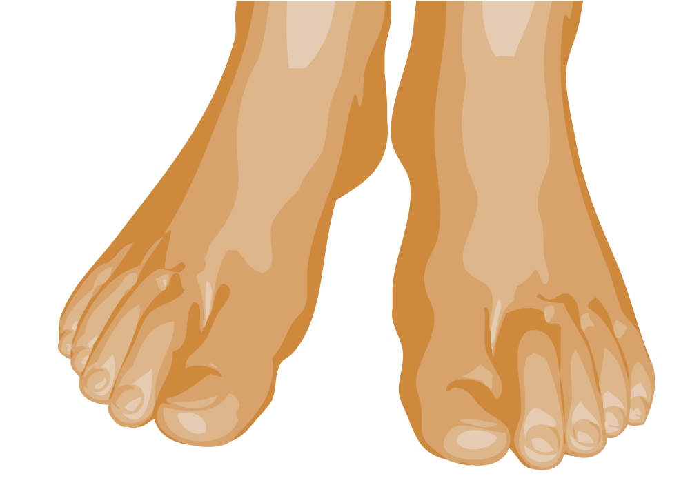 Image of feet related to Hammertoe problems