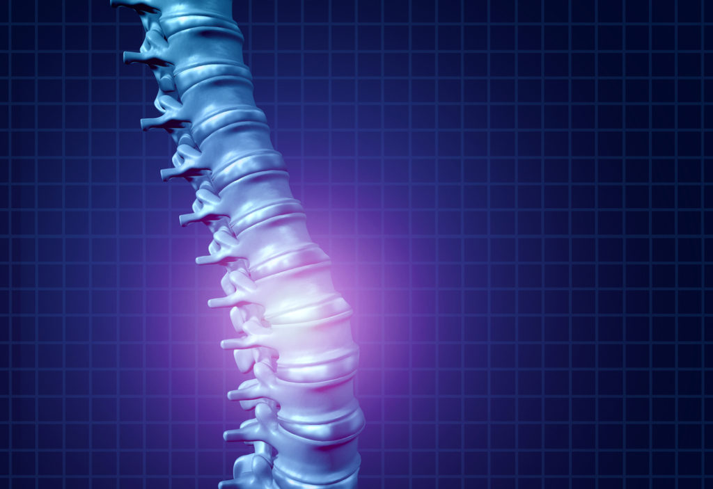 Back spine pain and human backache as a skeleton showing the spine and vertebral column in glowing highlight as a medical health care concept for spinal health and therapy as a 3D illustration.